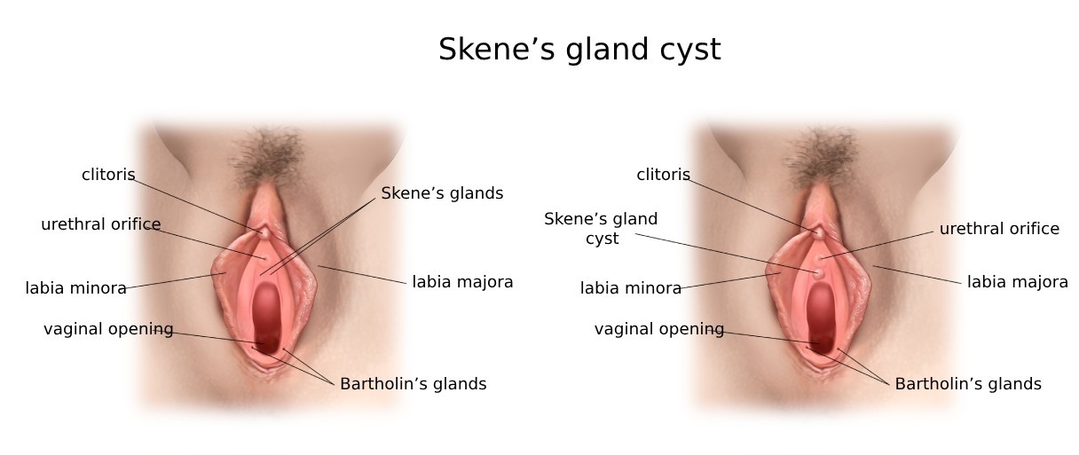 Skene Bezi: Ne İşe Yarar, Kist Belirtileri ve Tedavisi