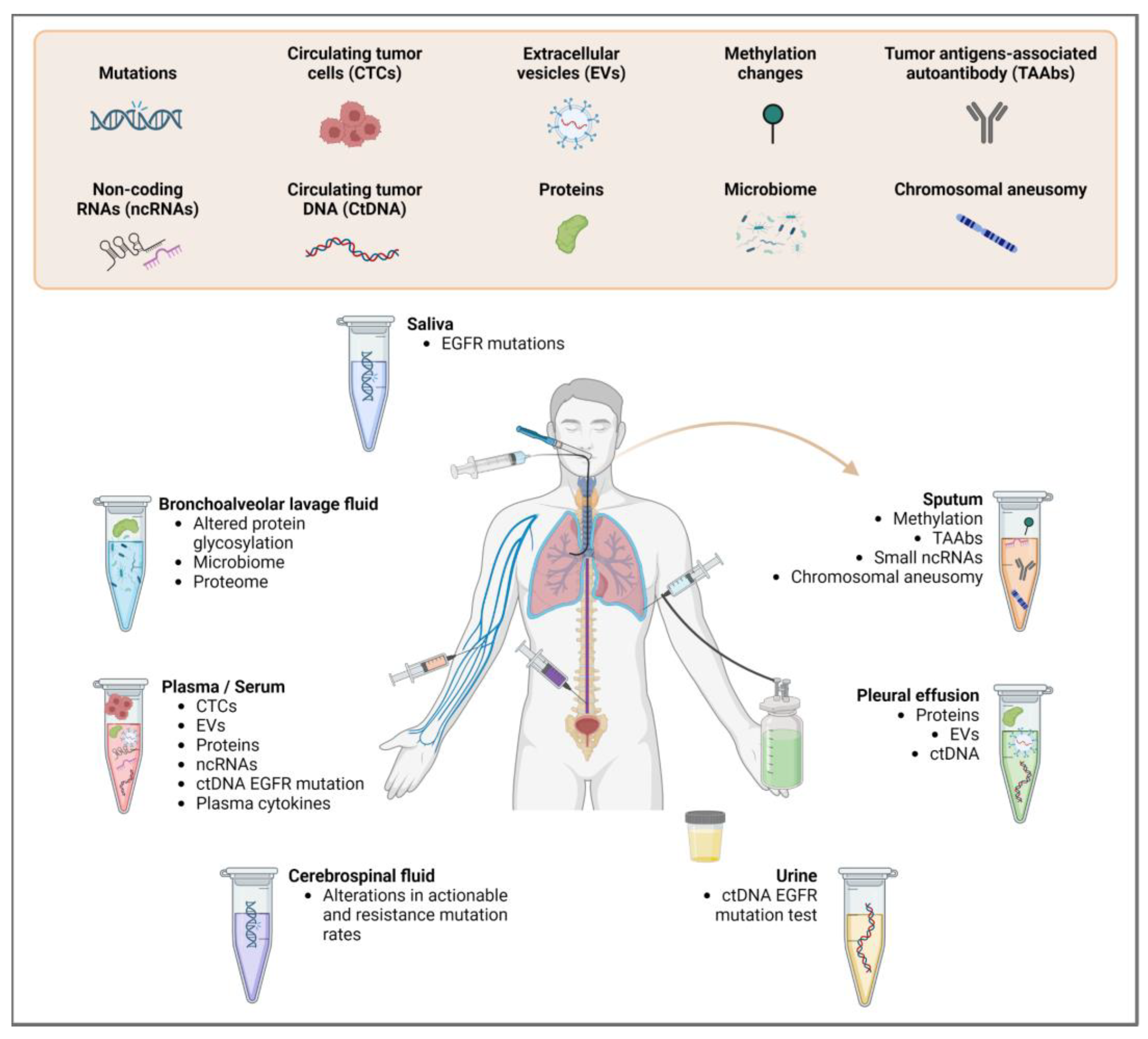Direkt Mesane Kanseri ile Hızlı İzlemde Sıvı Biyobelirteçleri (Mesane Lavaj Biyobelirteçleri)